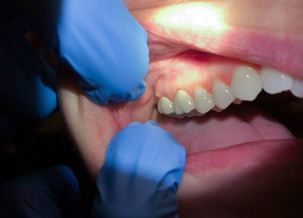 Best Broken or Chipped Tooth Repair in La Joya, TX